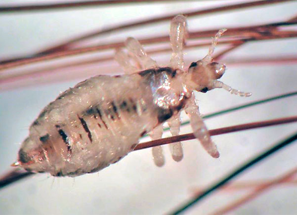 adult body louse