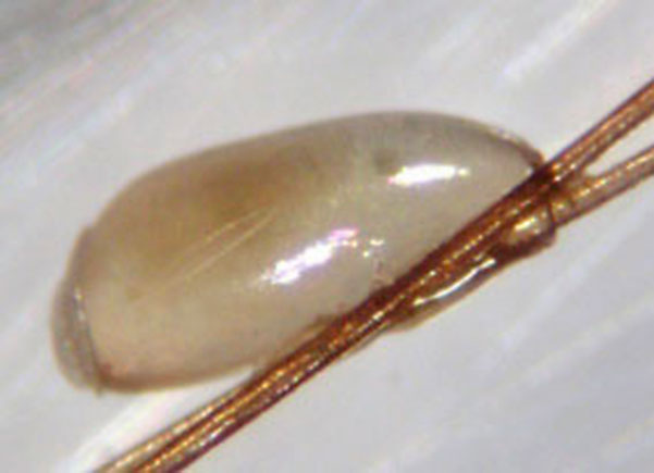 Vital body lice egg