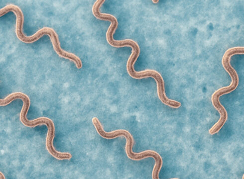 <i>Borrelia</i> en spirale